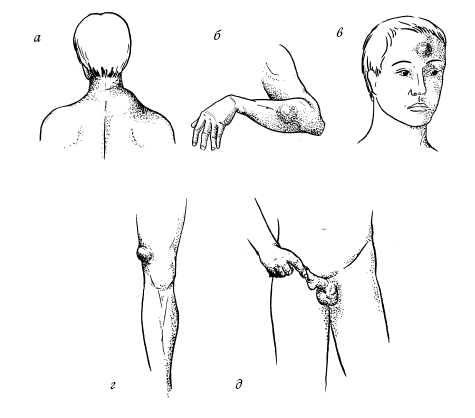 Лечение болезней и дефектов кожи. И жировик исчез, и бородавки i_001.png