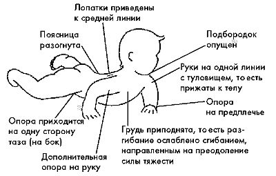 Ребенок с церебральным параличом : помощь, уход, развитие i_025.jpg