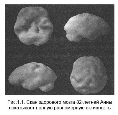 Измени мозг - изменится и тело _2.jpg