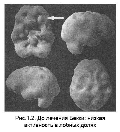 Измени мозг - изменится и тело _3.jpg