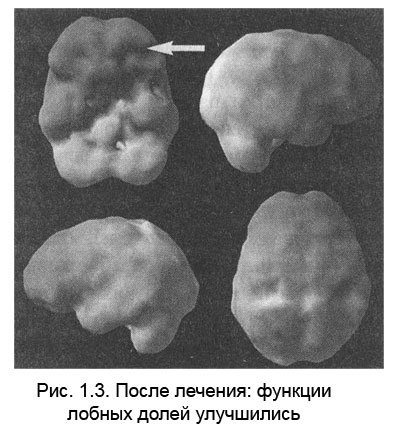 Измени мозг - изменится и тело _4.jpg