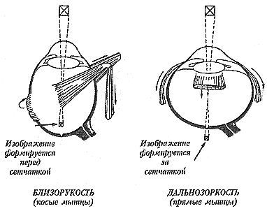 Улучшите ваше зрение _02.jpg