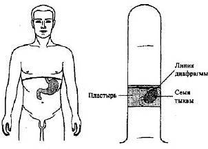 Пальцетерапия _45.jpg