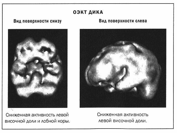 Мозг и душа _17.jpg