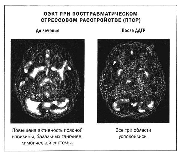 Мозг и душа _37.jpg