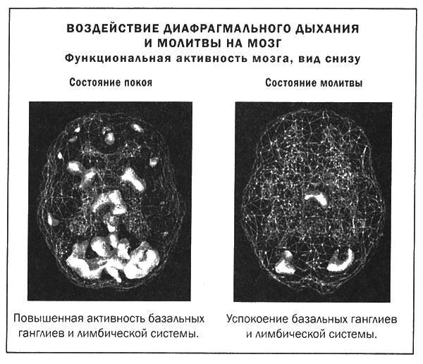 Мозг и душа _41.jpg