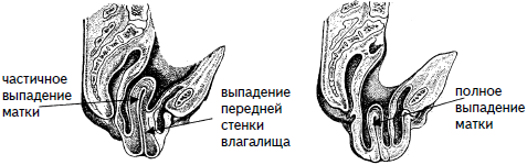 Гимнастика для женщин i_012.png