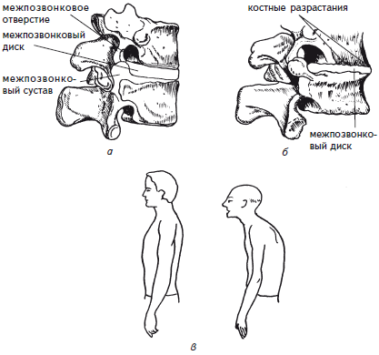 Как избавиться от боли в спине i_013.png