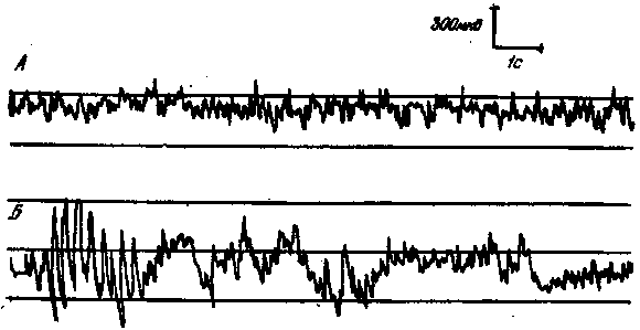 Мозг в электромагнитных полях i_009.png