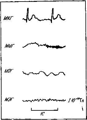 Мозг в электромагнитных полях i_013.png