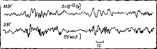 Мозг в электромагнитных полях i_014.png