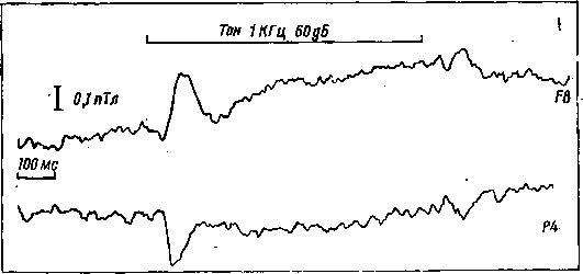 Мозг в электромагнитных полях i_015.png