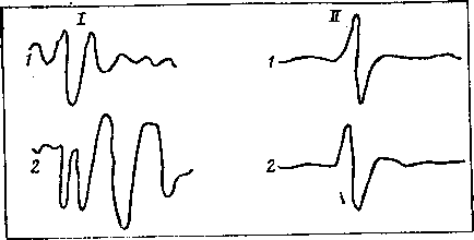 Мозг в электромагнитных полях i_016.png