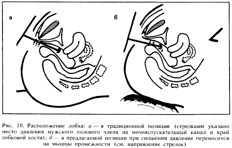 Искусство любви _10.png