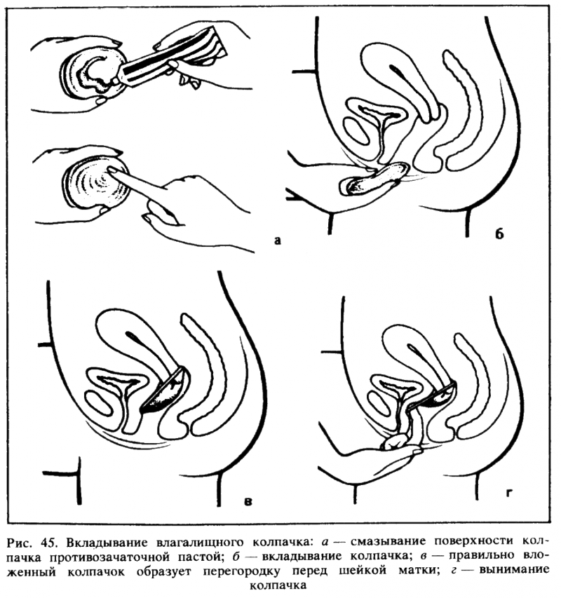 Искусство любви _47.png