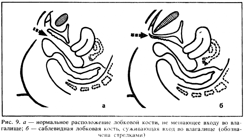 Искусство любви _9.png