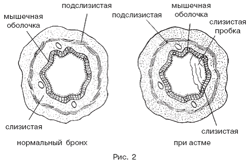 Массаж при заболеваниях органов дыхания pic_2.png